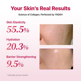 YADAH ingredient label detail highlighting hyaluronic acids and ceramide benefits
