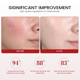 YAKINI Koriderm applied on hand demonstrating quick absorption and non-greasy finish