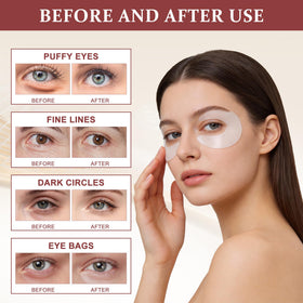 Ycz 3D contour patch applied across eye and temple for full coverage