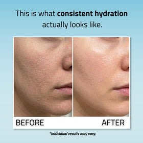 YEOUTH applied under light makeup showing smooth base and improved skin appearance