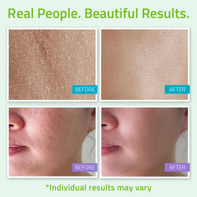 YEOUTH day night cream open jar showing lightweight texture and nourishment
