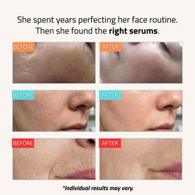 YEOUTH hyaluronic acid gel texture close-up demonstrating hydration and plumping effect