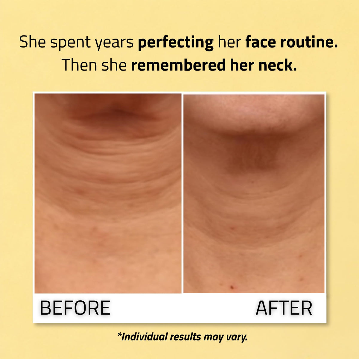 YEOUTH applying cream to neck demonstrating lift and smoother appearance
