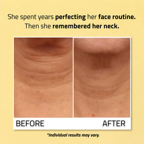 YEOUTH applying cream to neck demonstrating lift and smoother appearance