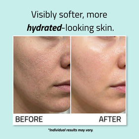 YEOUTH ingredient label close-up highlighting 99% hyaluronic acid concentration
