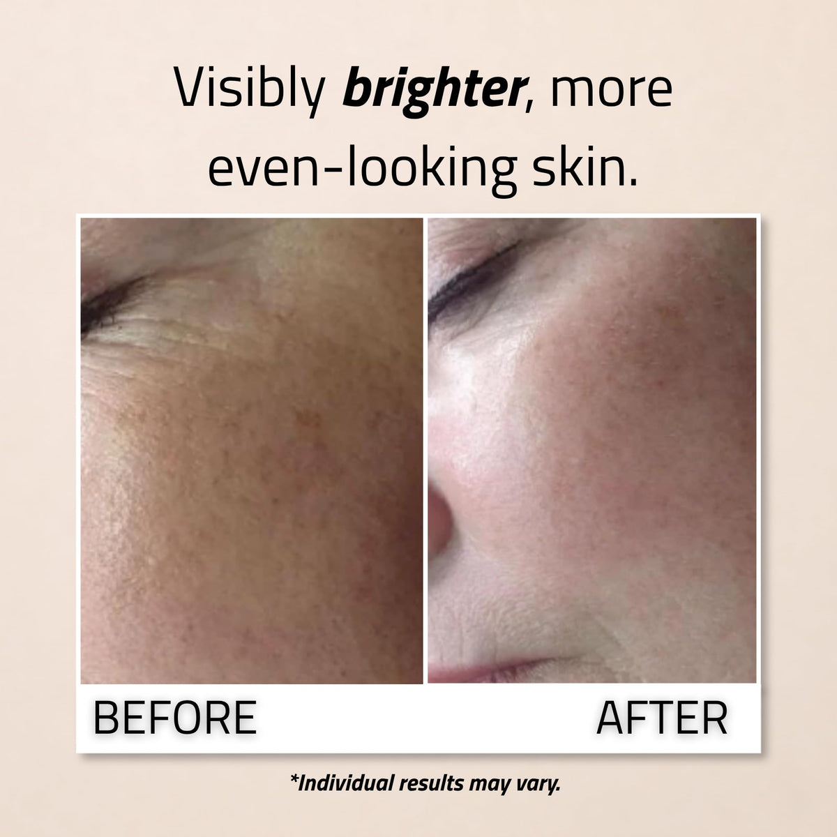 Applying YEOUTH serum to the face demonstrating even application and hydration boost