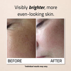 Applying YEOUTH serum to the face demonstrating even application and hydration boost