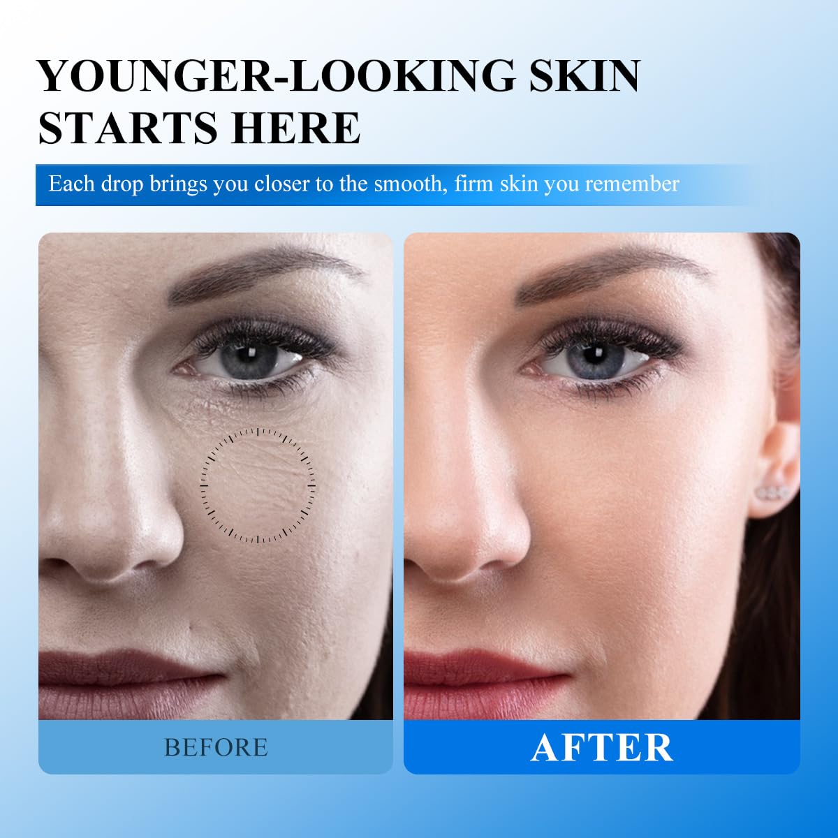 Yeweian application on skin demonstrating targeted patting for wrinkle-prone areas
