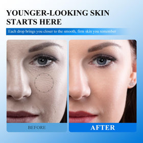 Yeweian application on skin demonstrating targeted patting for wrinkle-prone areas
