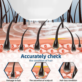 Yhaofu 50x scalp surface image showing oil balance to guide care