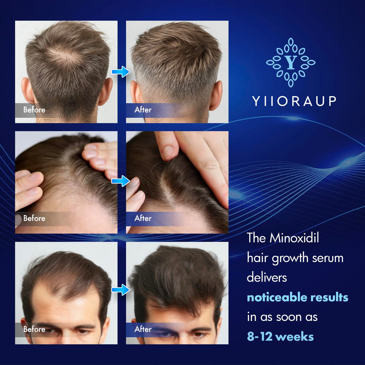 YIIORAUP texture close-up of clear, fast-absorbing formula without oily residue