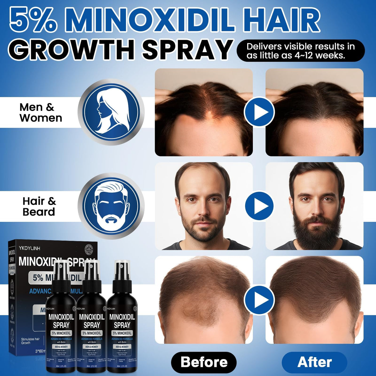YKDYLINH spraying onto scalp in use demonstrating convenient twice-daily application benefit