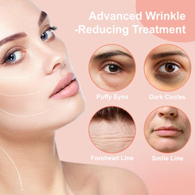 YLOTRE patch on forehead and smile lines showing targeted coverage