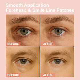 YLOTRE serum droplet showing formulation texture and hydration benefit