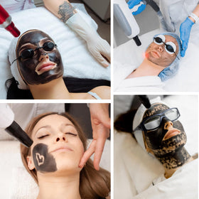 YMEYFAN paired with cooling gel illustrating post-treatment soothing benefit