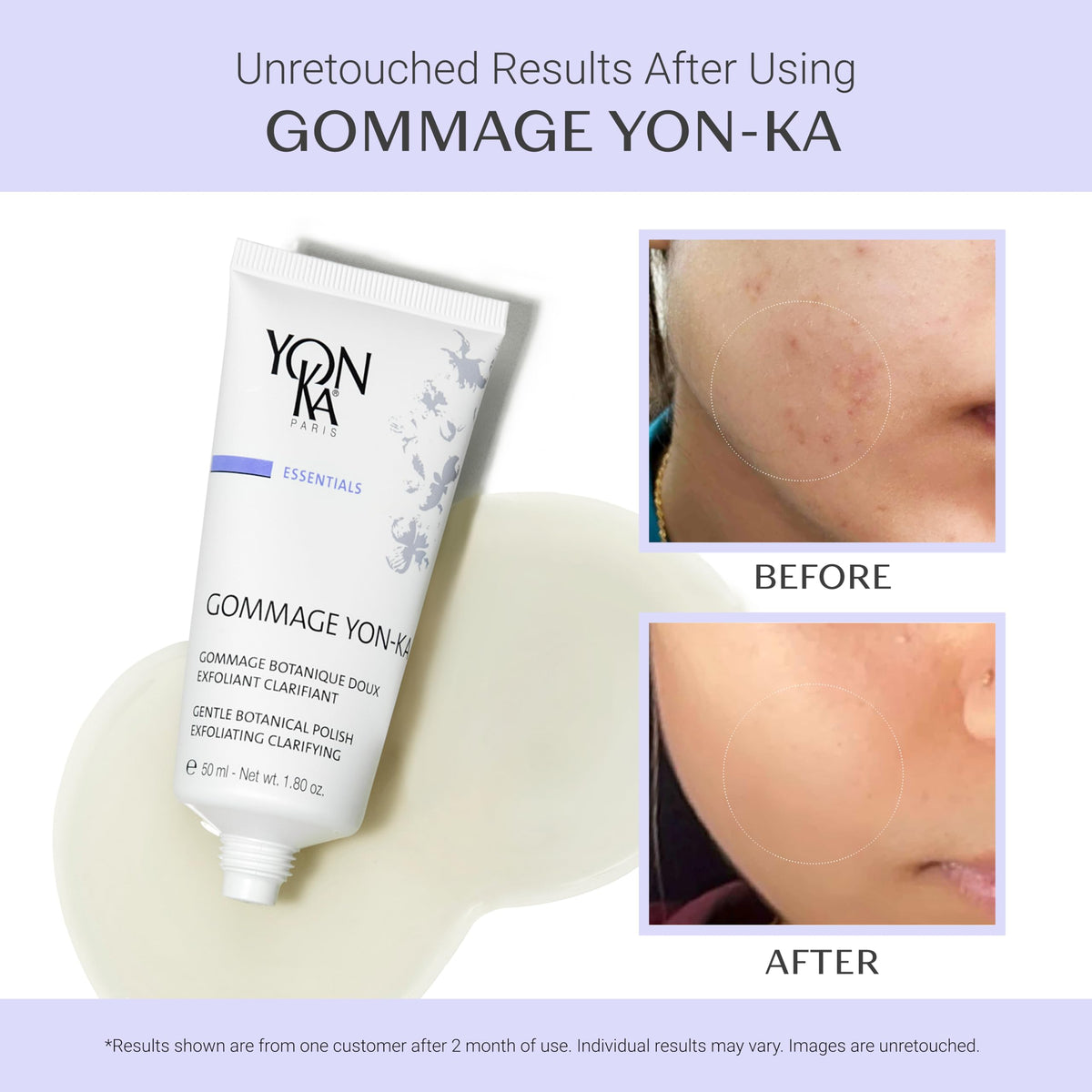 Yonka peeled flakes on skin showing exfoliation result and visible clarity