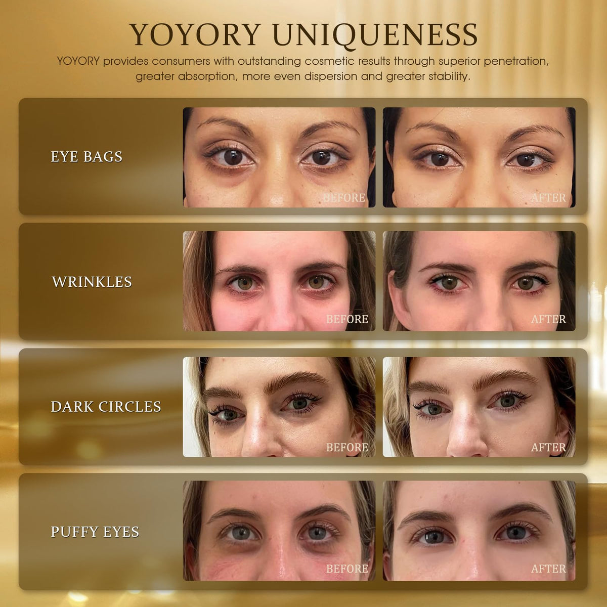 YOYORY open jar with stacked eye patches highlighting convenience and quantity