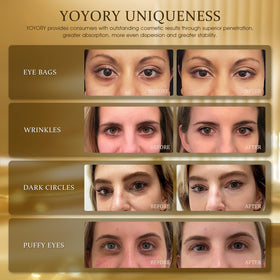 YOYORY open jar with stacked eye patches highlighting convenience and quantity