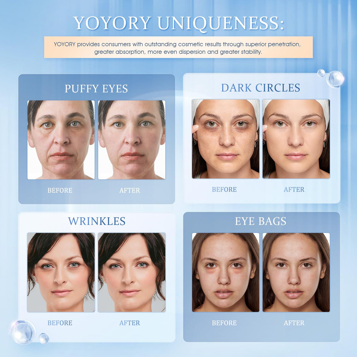 YOYORY single patch closeup highlighting smooth gel surface