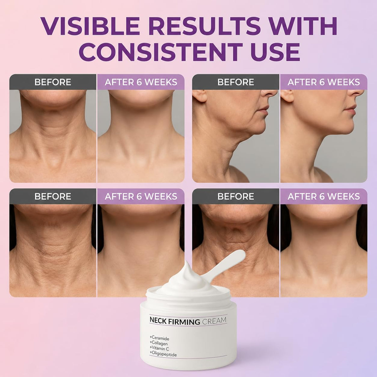 YTDB applied to neck in use demonstrating smooth absorption
