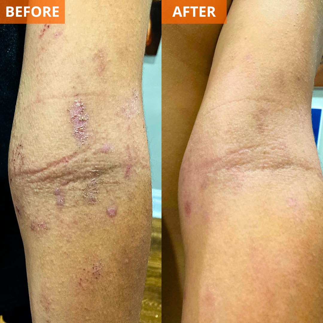Yu-Be on nightstand showing bedside hydration and overnight repair