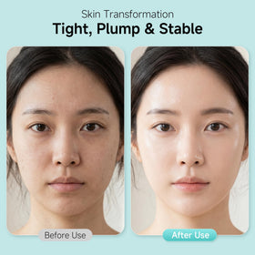 YUOJUNES ampoule in hand showing 2mL size for easy application