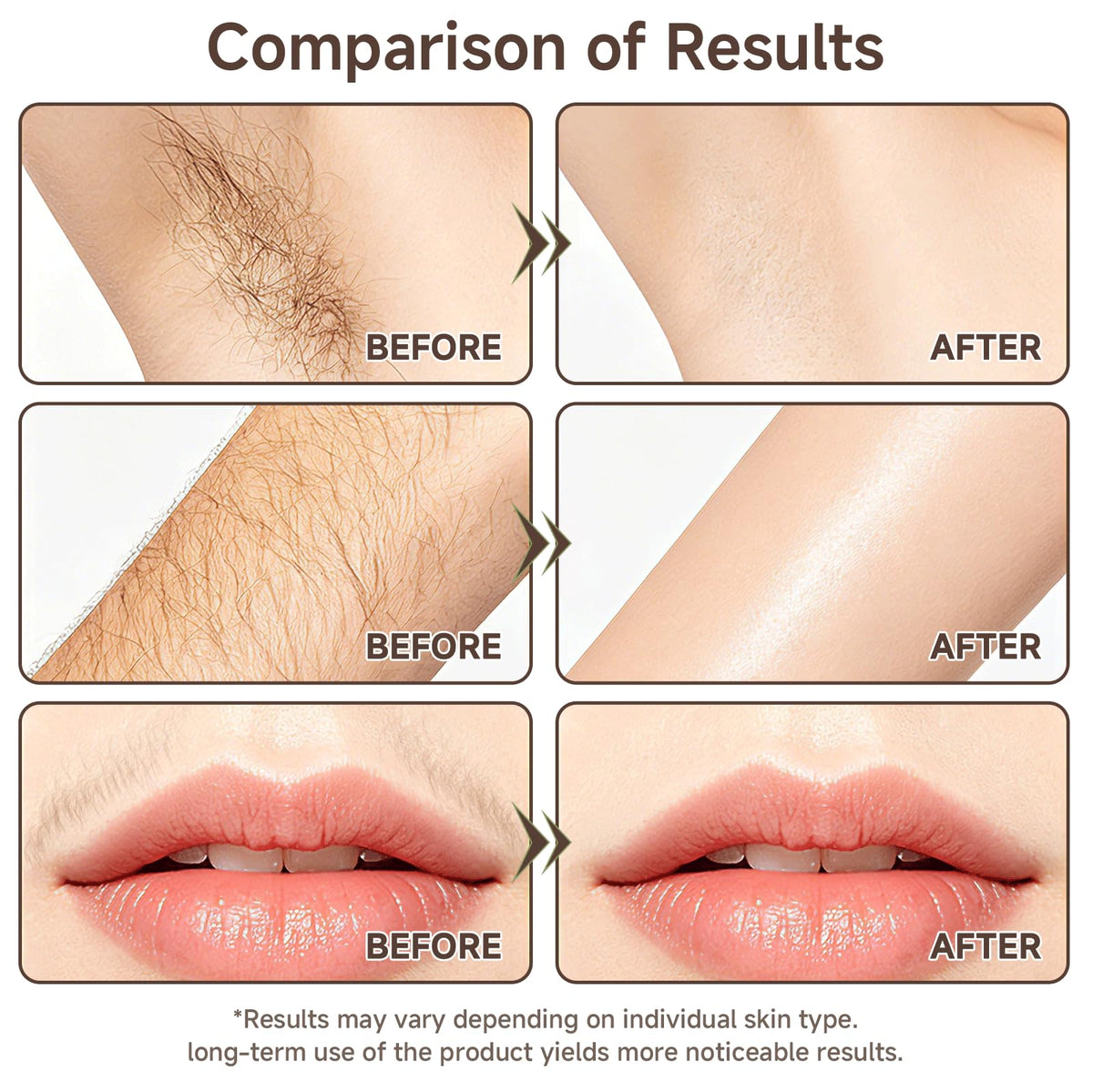 YXYoupin applied to underarm demonstrating smooth application and soothing benefit