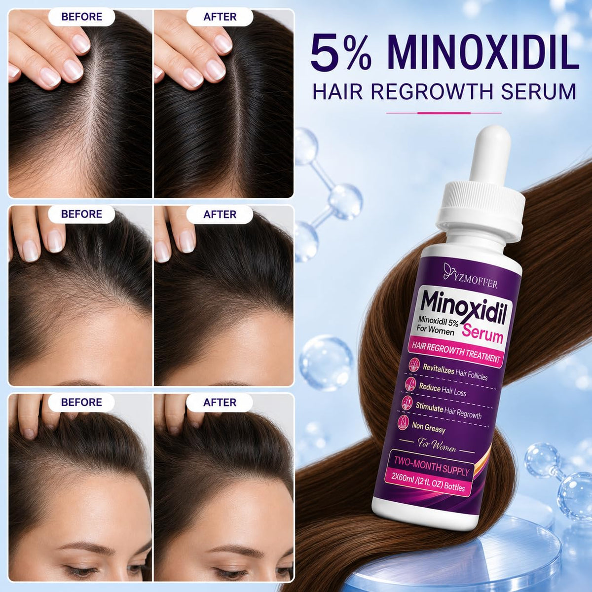 Yzmoffer serum texture close-up demonstrating lightweight, non-greasy formula