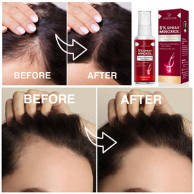 Yzmoffer woman applying spray to thinning area for targeted use