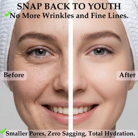 ZAKUTO mask applied on model at bedtime demonstrating overnight use