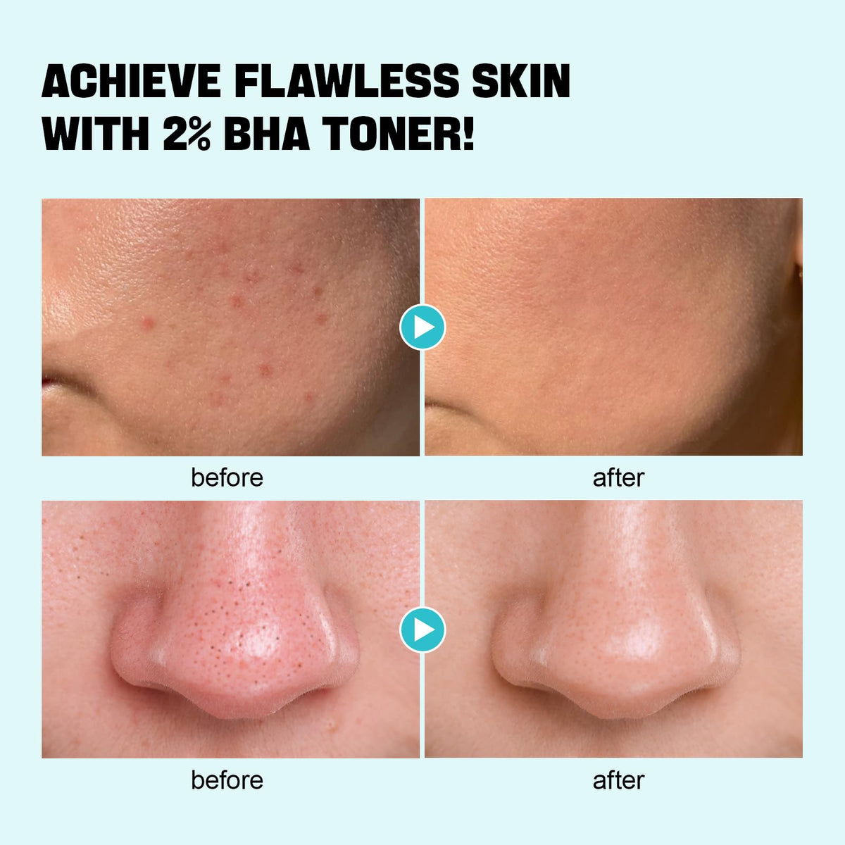 ZealSea application on cotton pad demonstrating gentle pore-clearing benefit