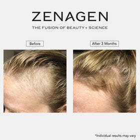 Zenagen Revolve on bathroom shelf in lifestyle setting implying daily use