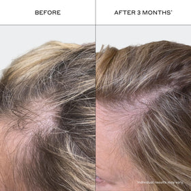 Zenagen Revolve stylized before and after hair showing fuller-looking results