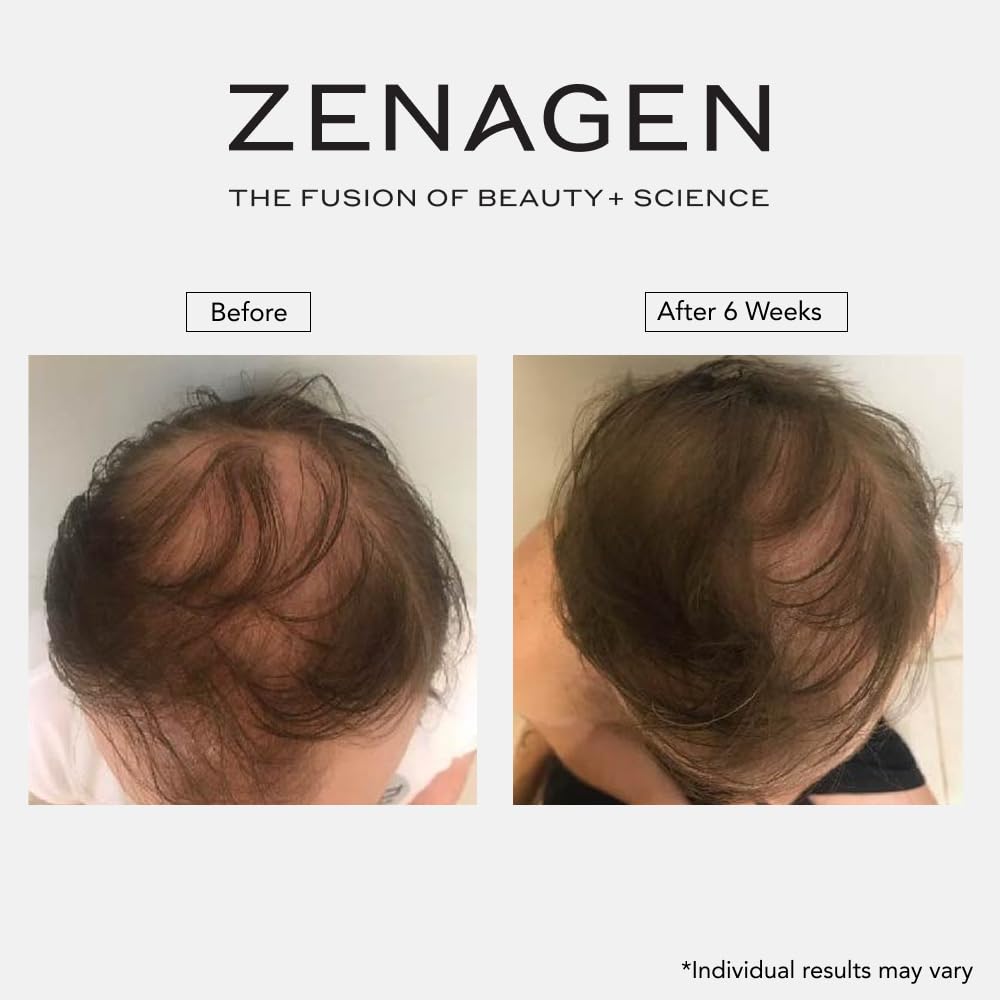 Zenagen Revolve packaging label detail focusing on plant-based formulation benefits
