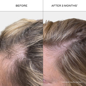 Zenagen Revolve shampoo texture pouring to show lightweight, non-greasy formula benefit