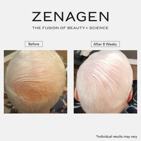 Zenagen Revolve 16 oz next to a ruler for size comparison and long-lasting use