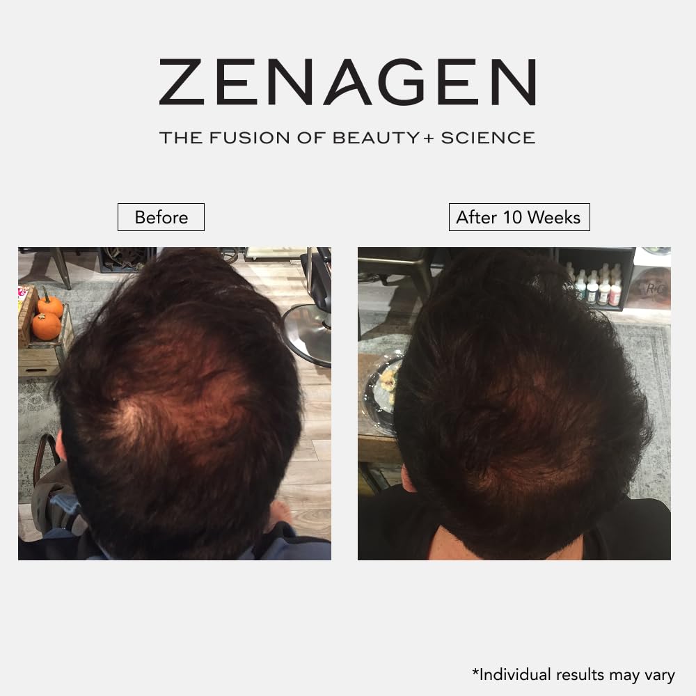 Zenagen Revolve next to a 200 mL scale showing travel-friendly size