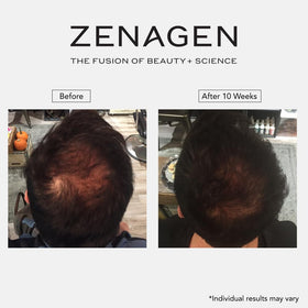Zenagen Revolve next to a 200 mL scale showing travel-friendly size