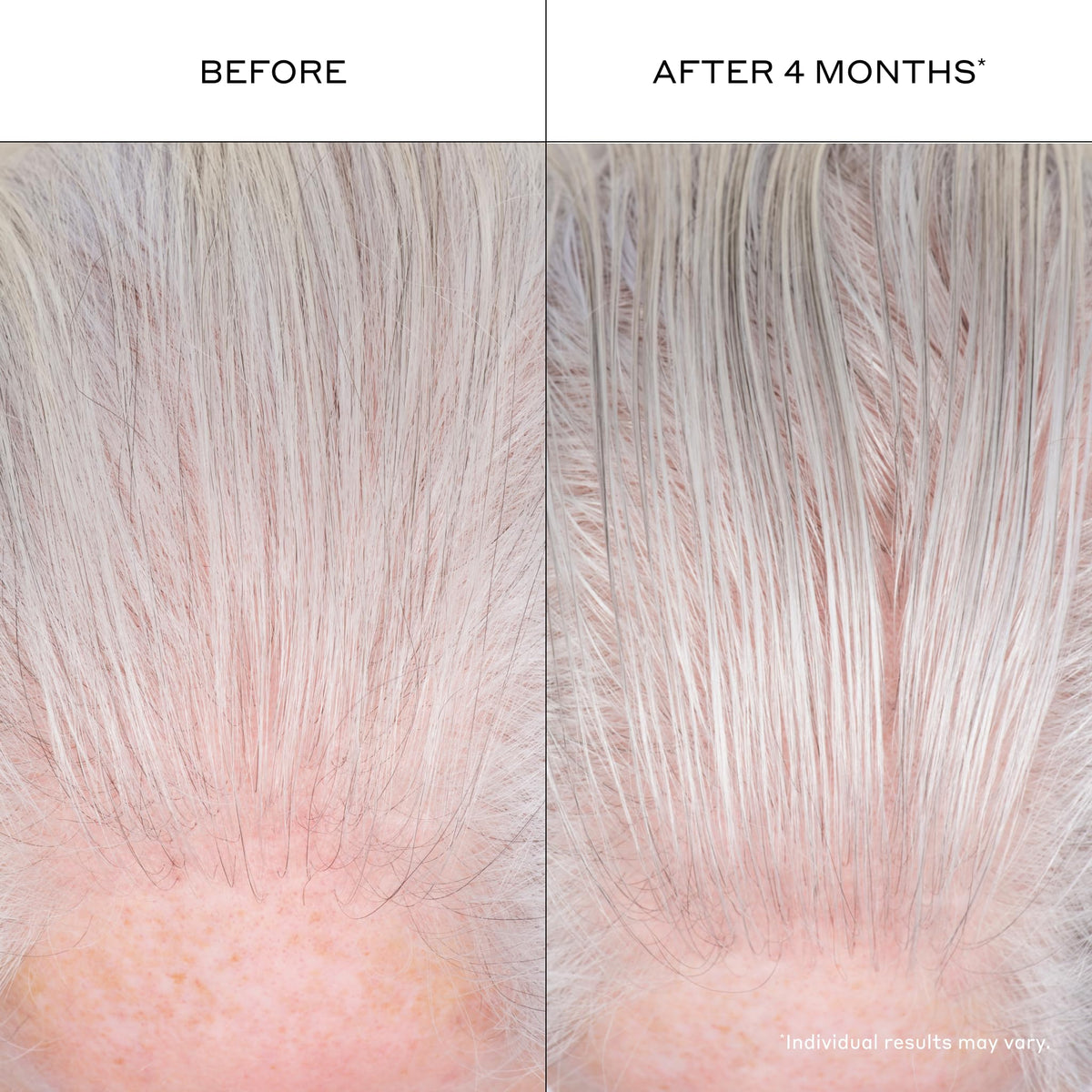 Zenagen before and after styled hair illustrating fuller-looking results benefit