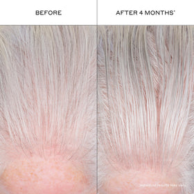 Zenagen before and after styled hair illustrating fuller-looking results benefit
