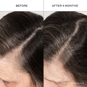 Zenagen applying serum to scalp showing improved root appearance benefit