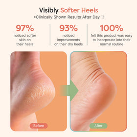 ZenToes open-toe design detail showing breathability and comfort benefit
