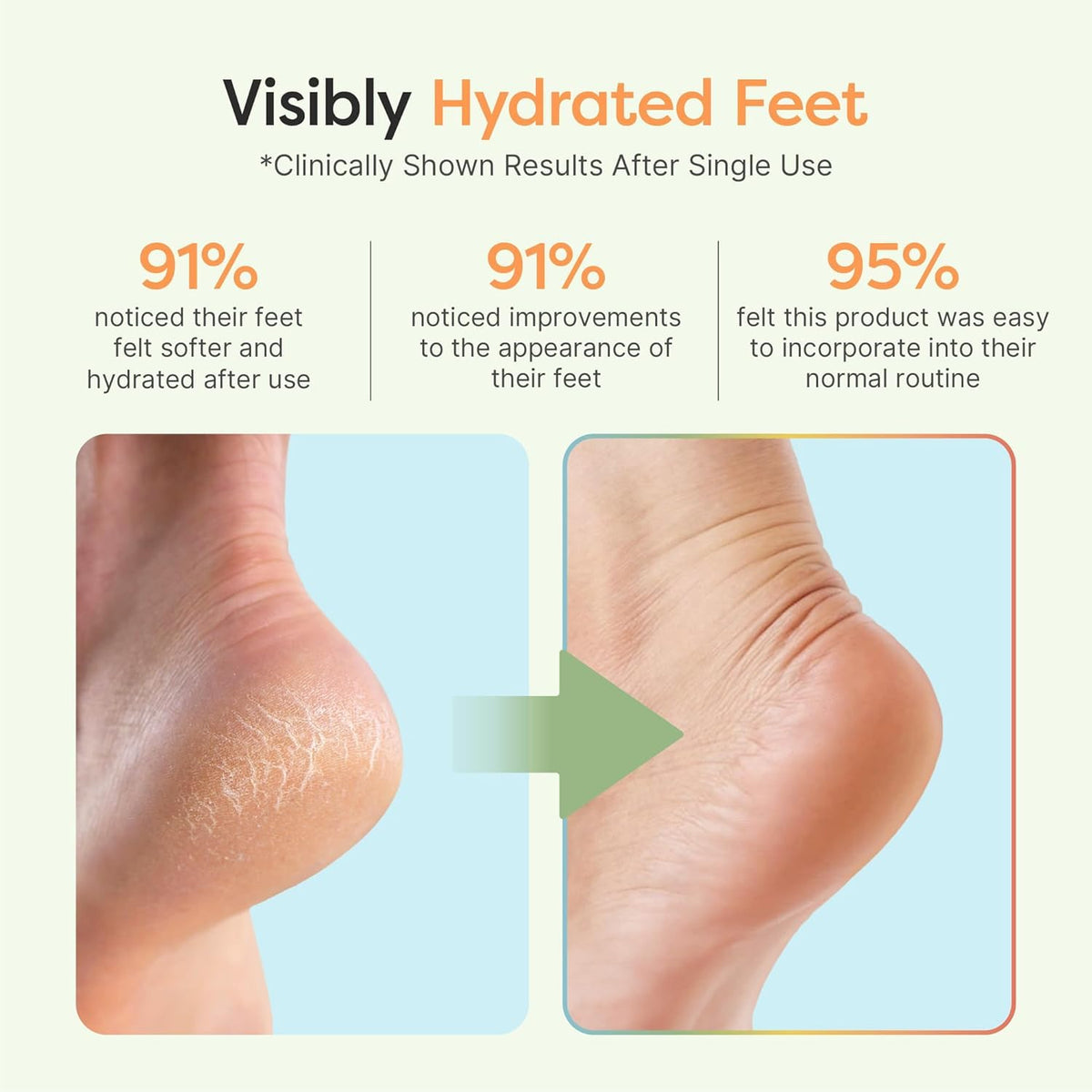 ZenToes open-toe design visible for breathability and comfort
