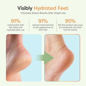 ZenToes open-toe design visible for breathability and comfort