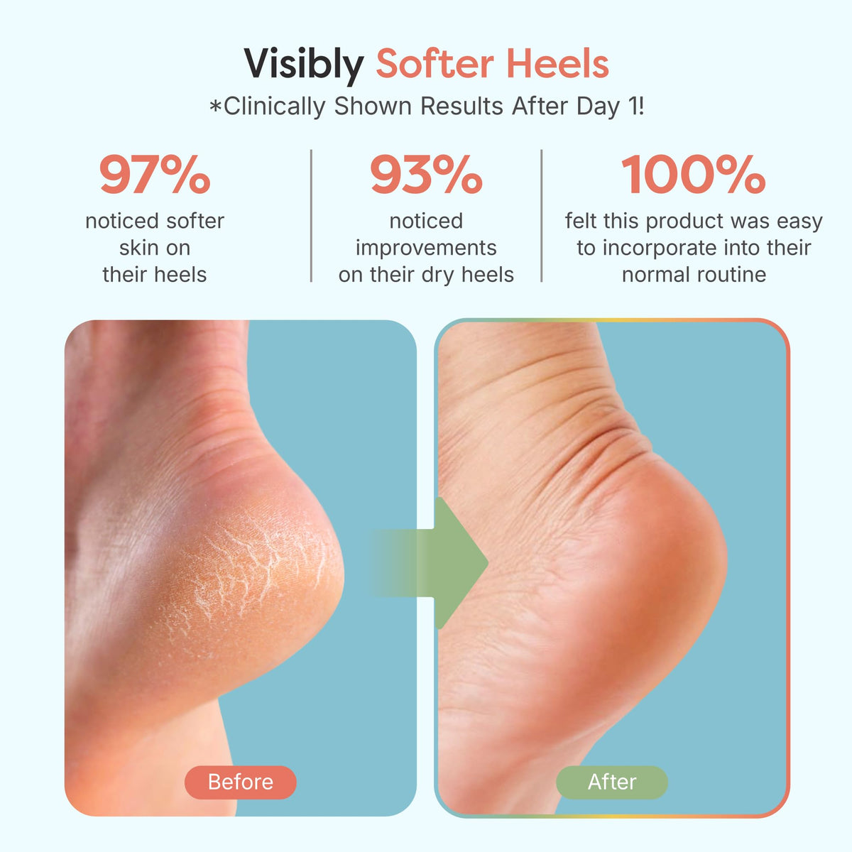 ZenToes open-toe detail showing breathability and cooler, comfortable wear