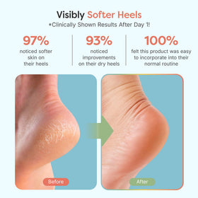 ZenToes open-toe detail showing breathability and cooler, comfortable wear