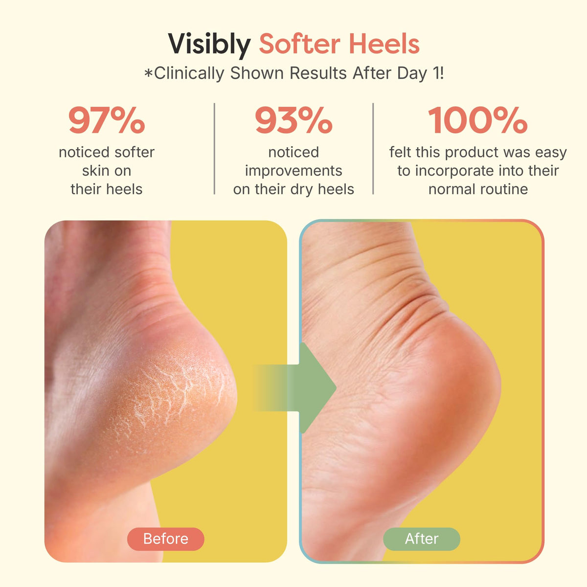 ZenToes open-toe design detail allowing breathability and toe freedom
