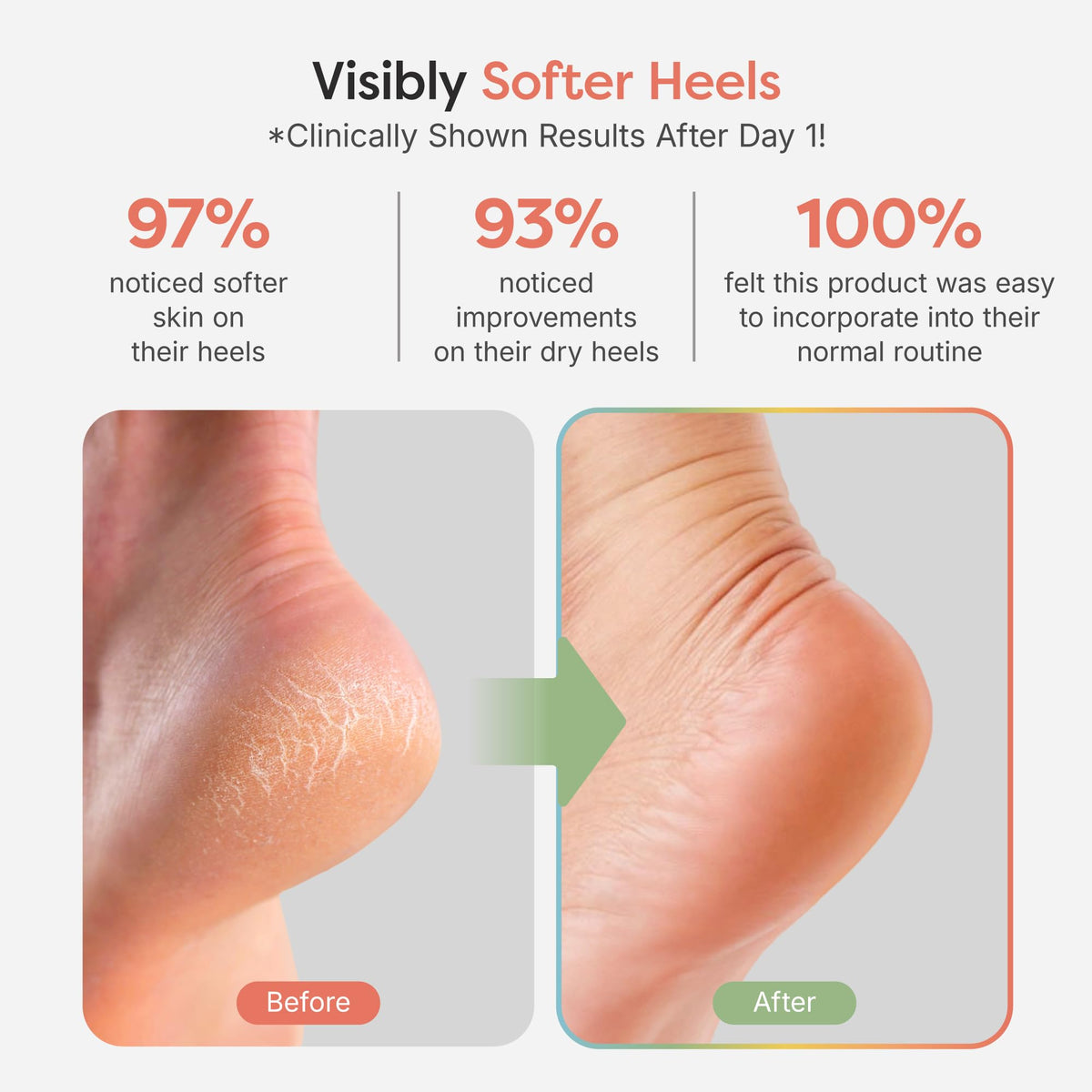 ZenToes open-toe design detail showing breathable fit and comfort benefit