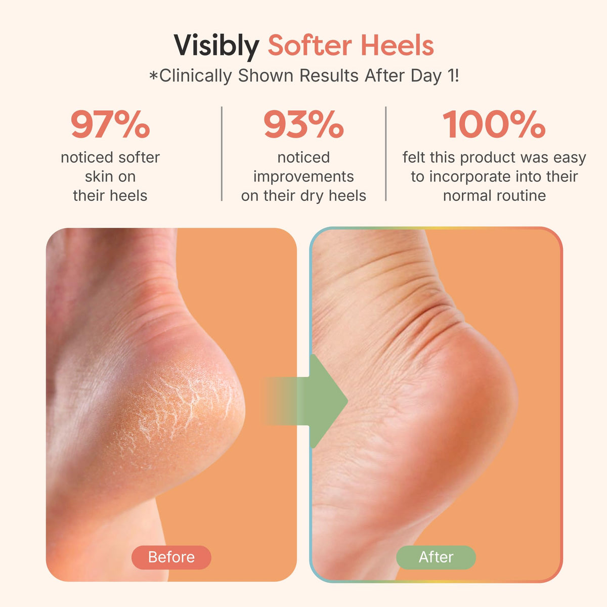 ZenToes open-toe design top view ensuring breathability and cooler wear