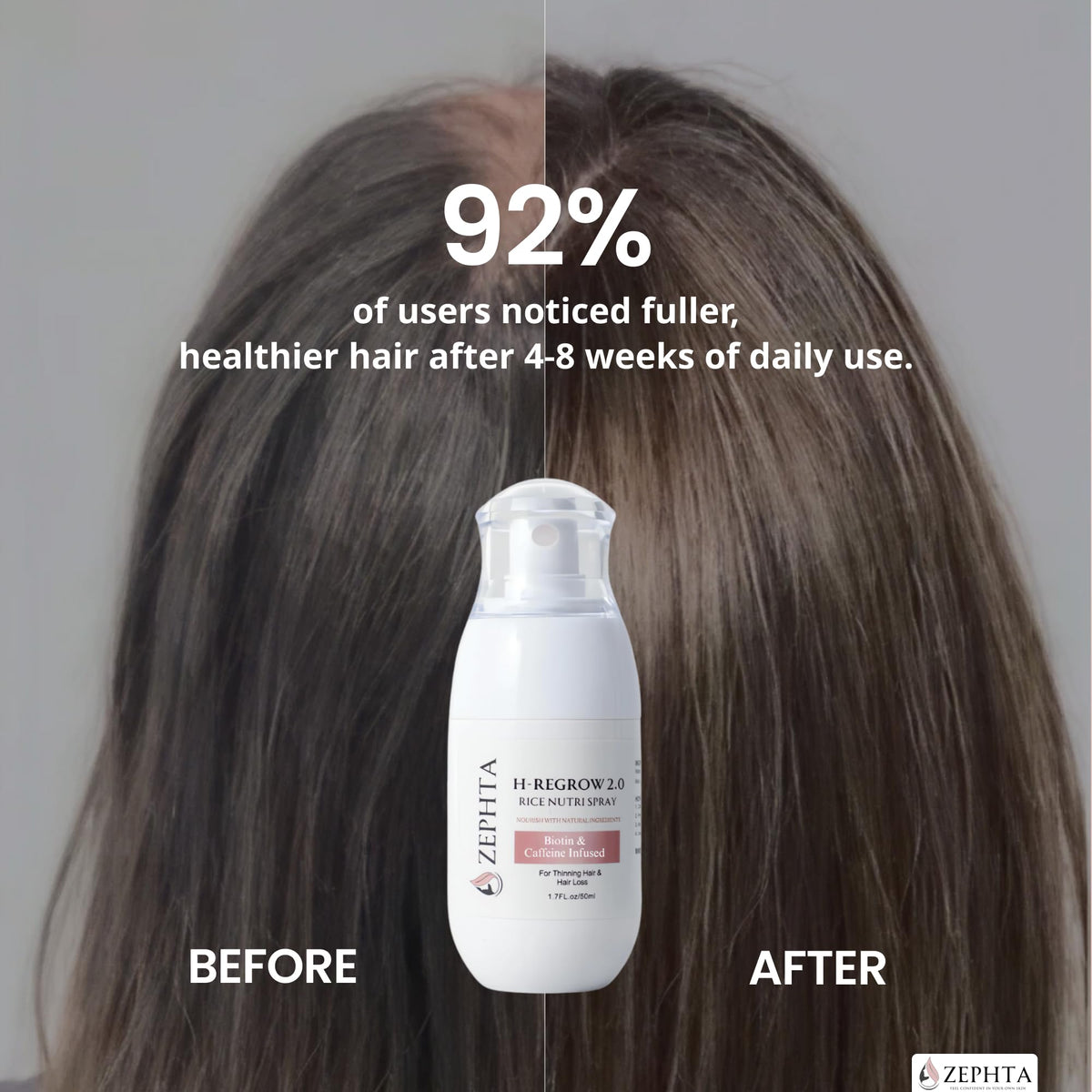 Zephta being applied to thinning crown to boost scalp nourishment